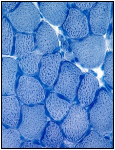 Photo of slow and fast twitch muscle fibers in the quadriceps muscle of a mouse.